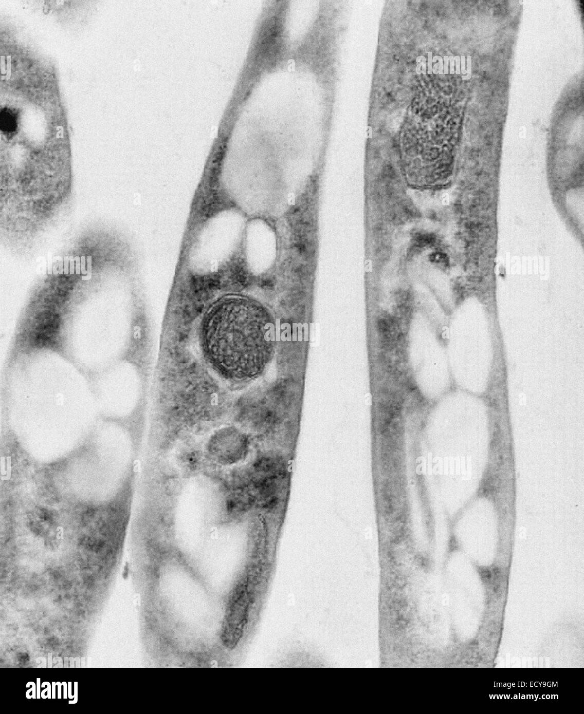 Mikrophotographie von Bacillus Anthracis (Milzbrand) Sporen. Stockfoto