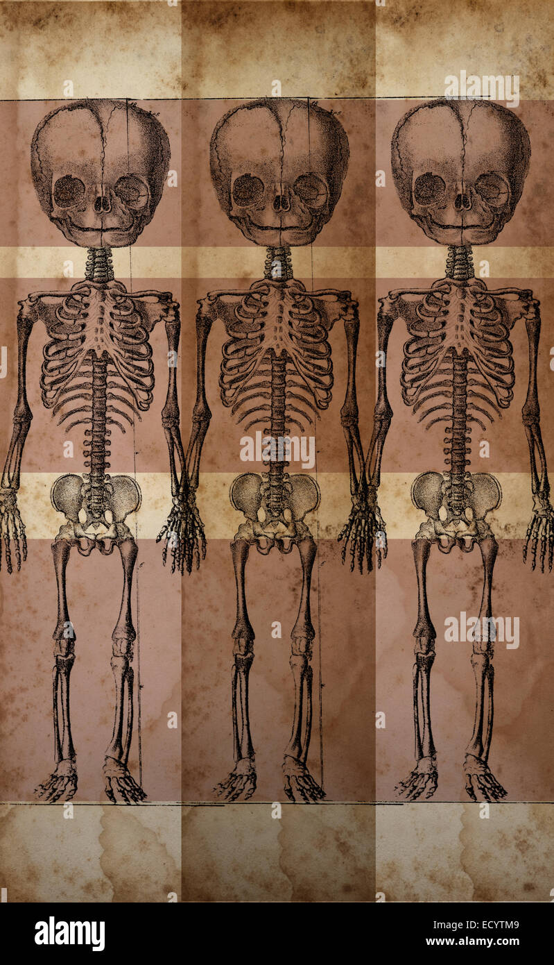 Vintage-Illustration eines Skeletts eines Kindes. Stockfoto