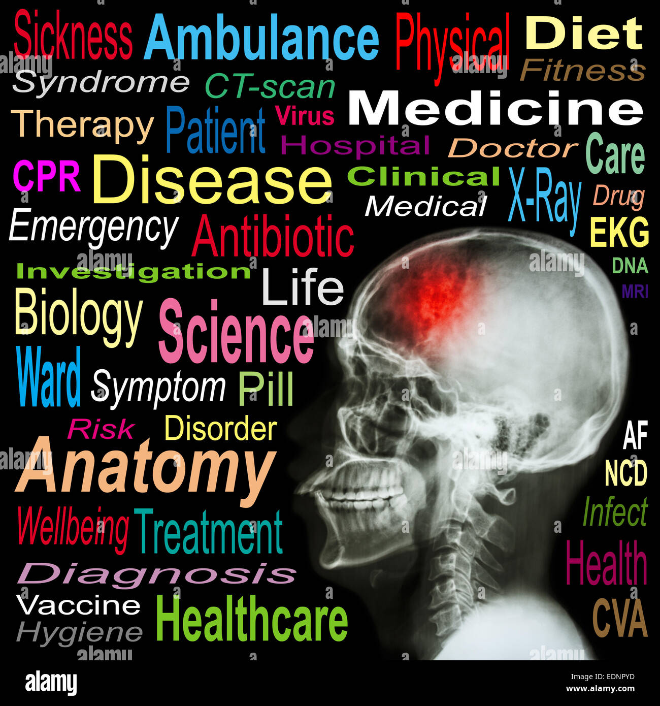 Röntgen Schädel und "Schlaganfall" und Medical Wortwolke Stockfoto