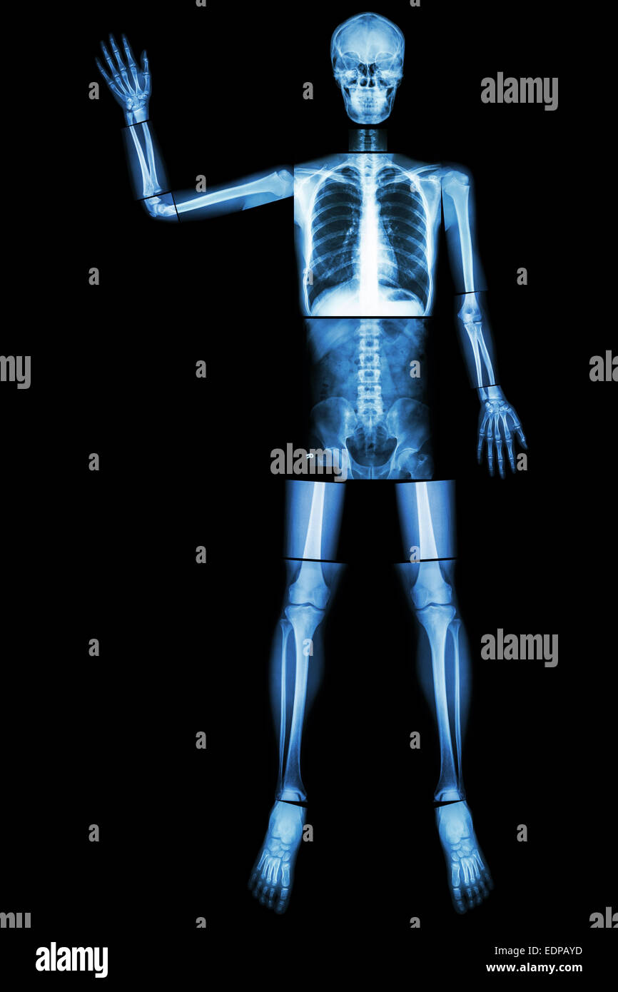 Good Bye EBOLA. (Menschliche Knochen Welle der Hand) (Ganzer Körper: Kopf Hals Wirbelsäule Schulter Arm Ellenbogen Unterarm Handgelenk Hand Finger Thorax Hea Stockfoto