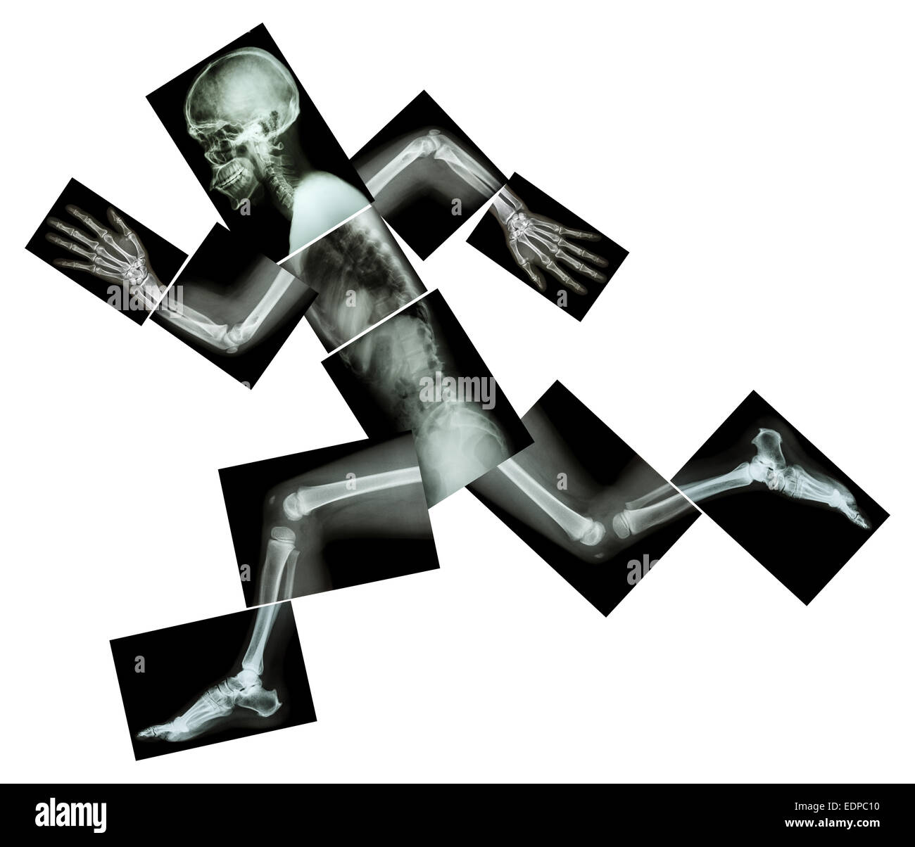 Marathon (menschliche Knochen läuft), (Ganzkörper Röntgen: Kopf, Hals, Schulter, Arm, Ellenbogen, Unterarm, Hand, Finger, Gelenk, Thorax, Ab Stockfoto