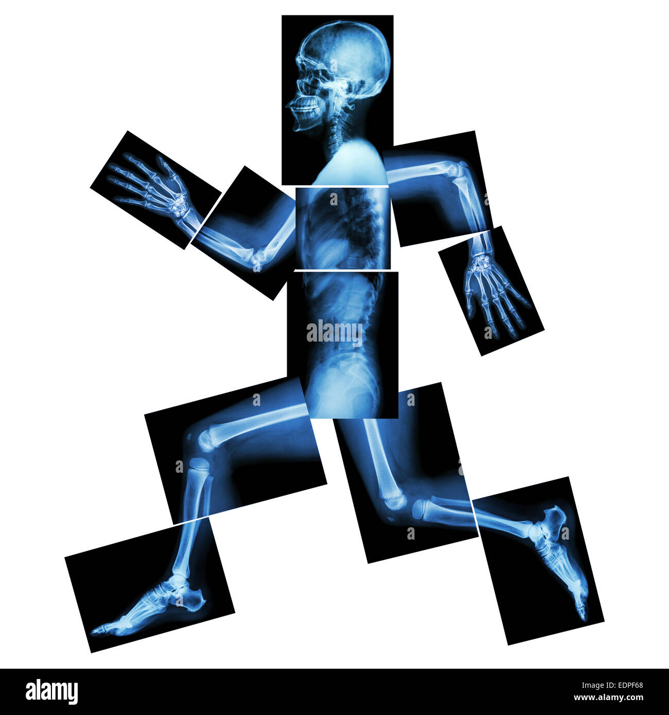 Aerobic-Übungen (menschliche Knochen läuft), (Ganzkörper Röntgen: Kopf, Hals, Schulter, Schulter, arm, Ellenbogen, Unterarm, hand, finger Stockfoto