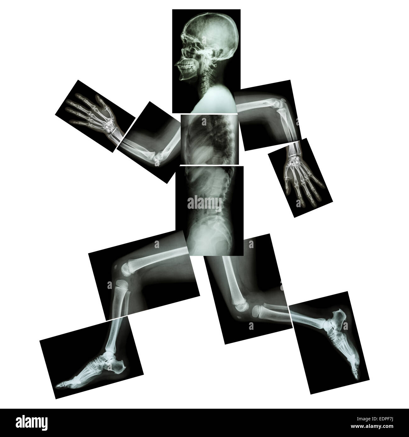 Aerobic-Übungen (menschliche Knochen läuft), (Ganzkörper Röntgen: Kopf, Hals, Schulter, Schulter, arm, Ellenbogen, Unterarm, hand, finger Stockfoto