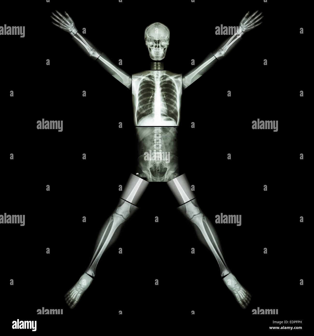 Brust strecken -Fotos und -Bildmaterial in hoher Auflösung – Alamy
