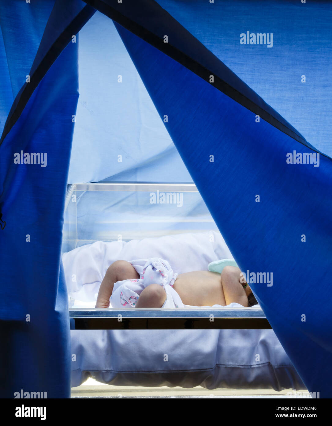 Neugeborenen-Gelbsucht Neugeborenen war Therapie durch Phototherapie Stockfoto