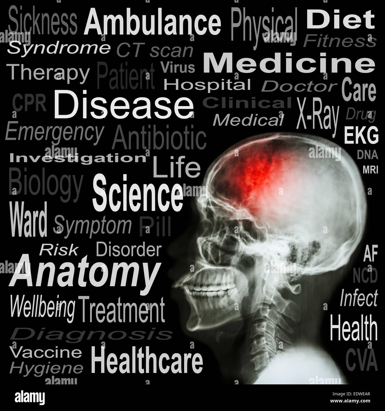 Röntgen Schädel und medizinischer text Stockfoto