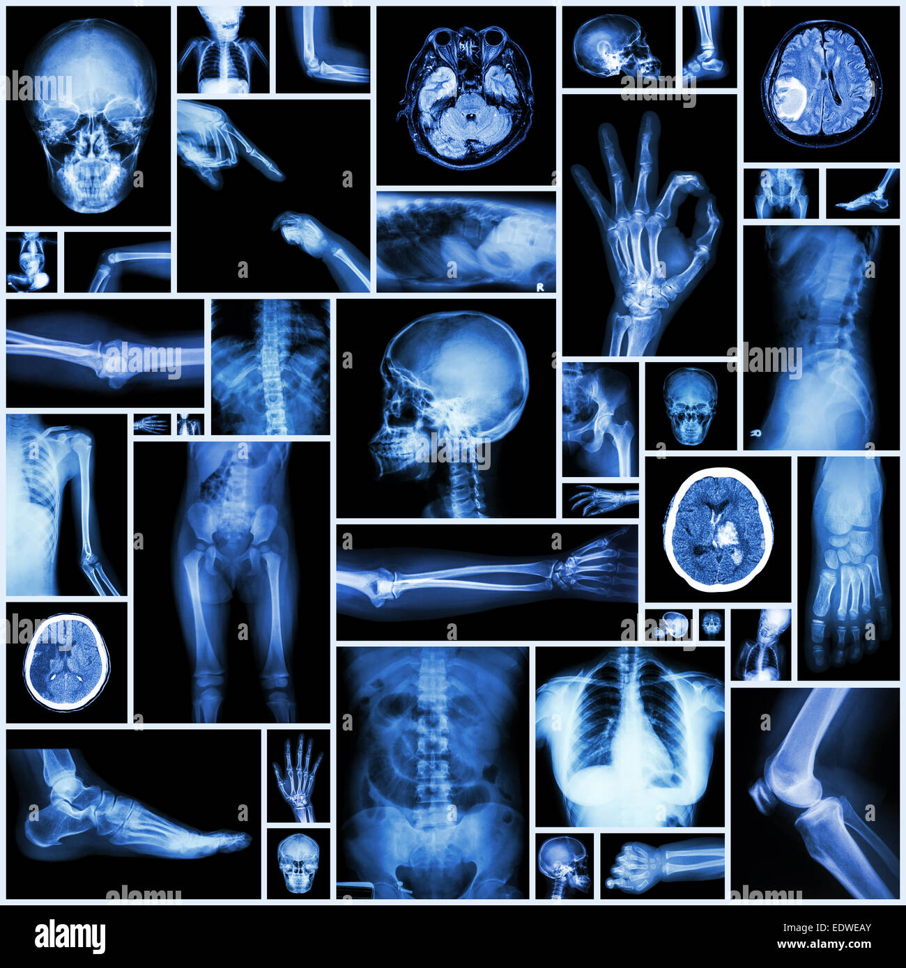X-ray mehrere Teile des menschlichen Stockfoto