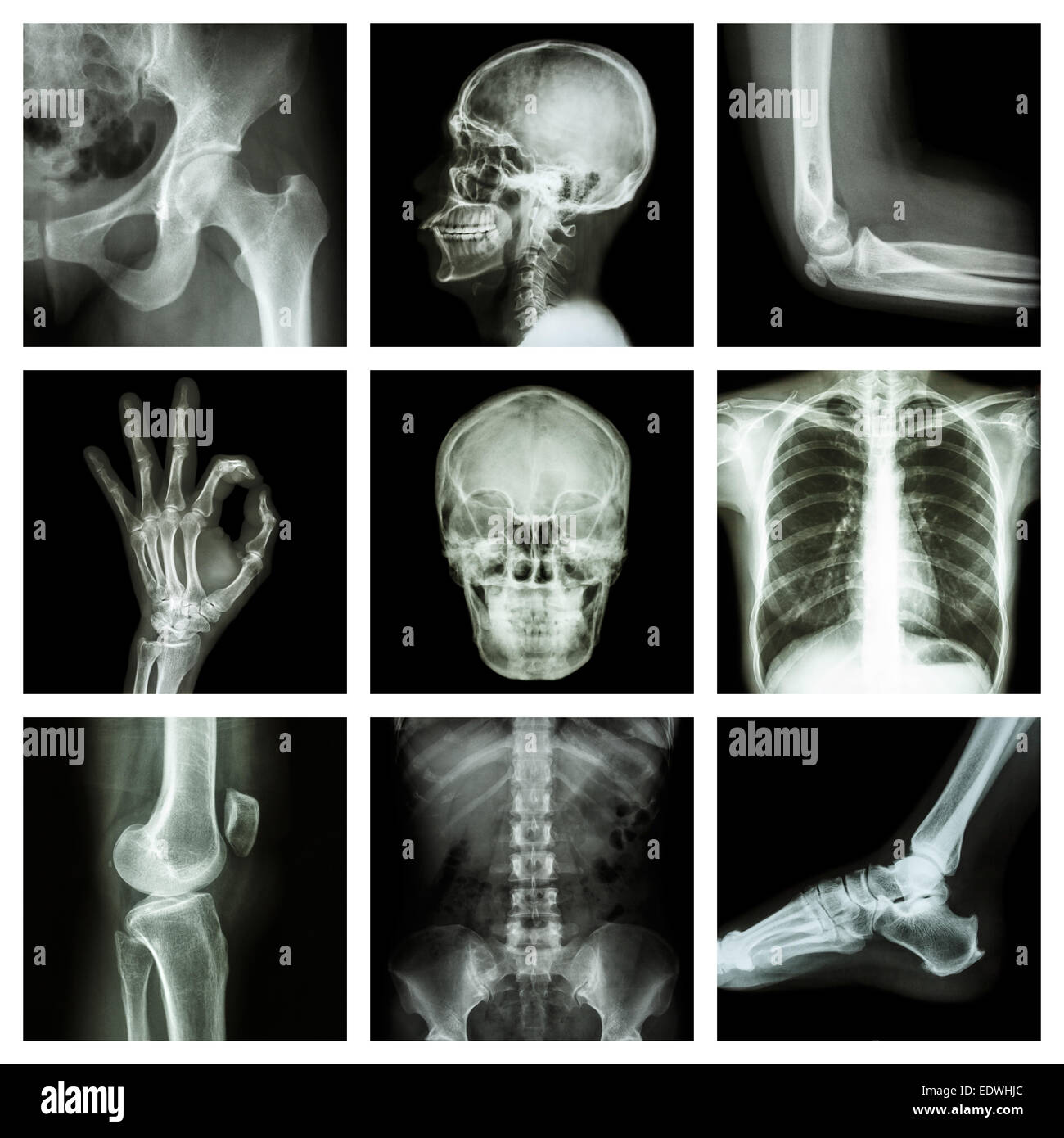 Kollektion x-ray Teil der menschlichen Stockfoto