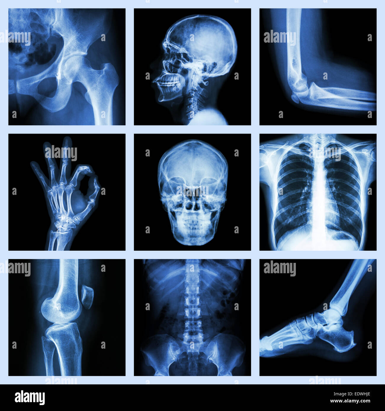 Kollektion x-ray Teil der menschlichen Stockfoto