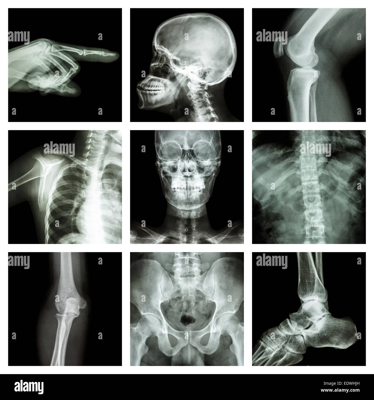Kollektion x-ray Teil der menschlichen Stockfoto