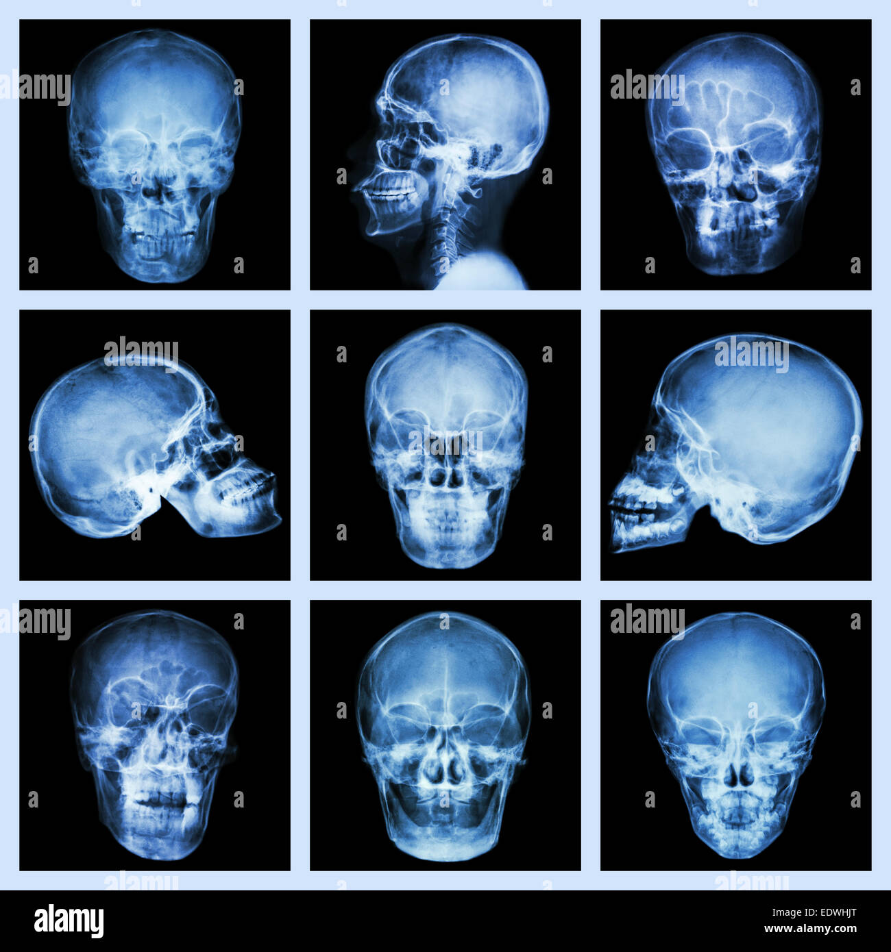 Sammlung von asiatischen Schädel Stockfoto