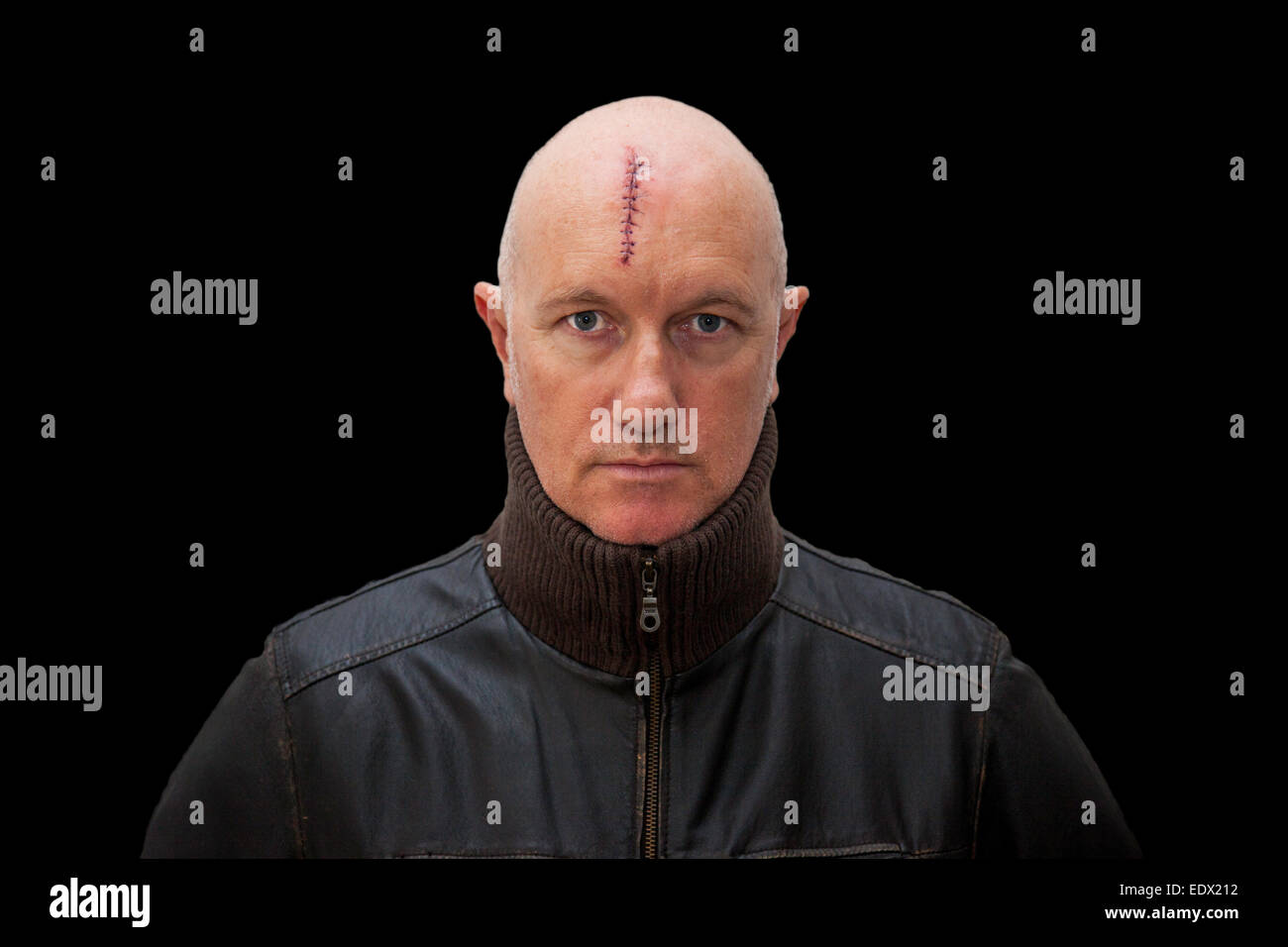 Böse aussehenden Mann mit eine schwere Kopfverletzung, die direkt in die Kamera schaut Stockfoto