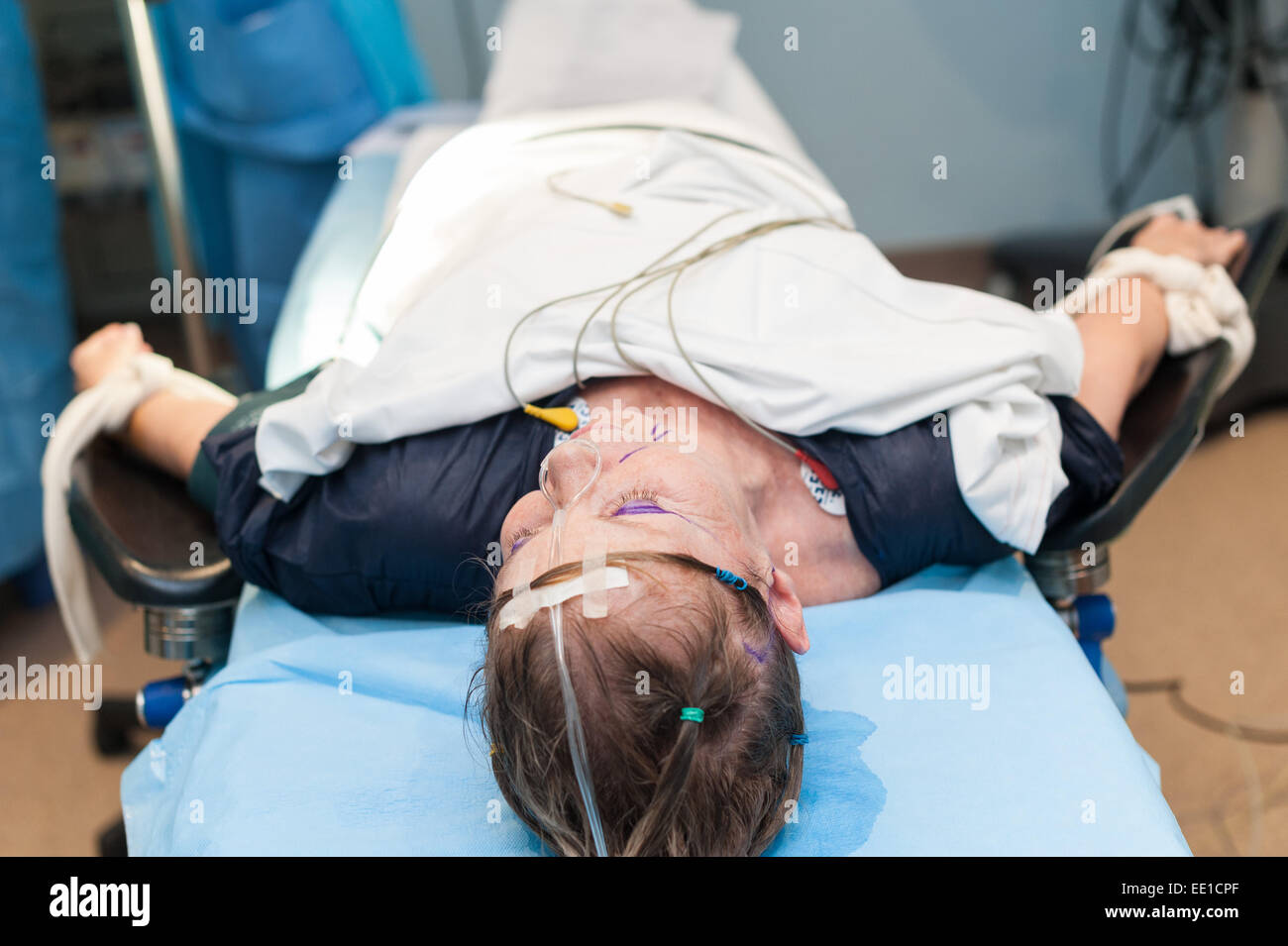 PLASTISCHE GESICHTSCHIRURGIE Stockfoto