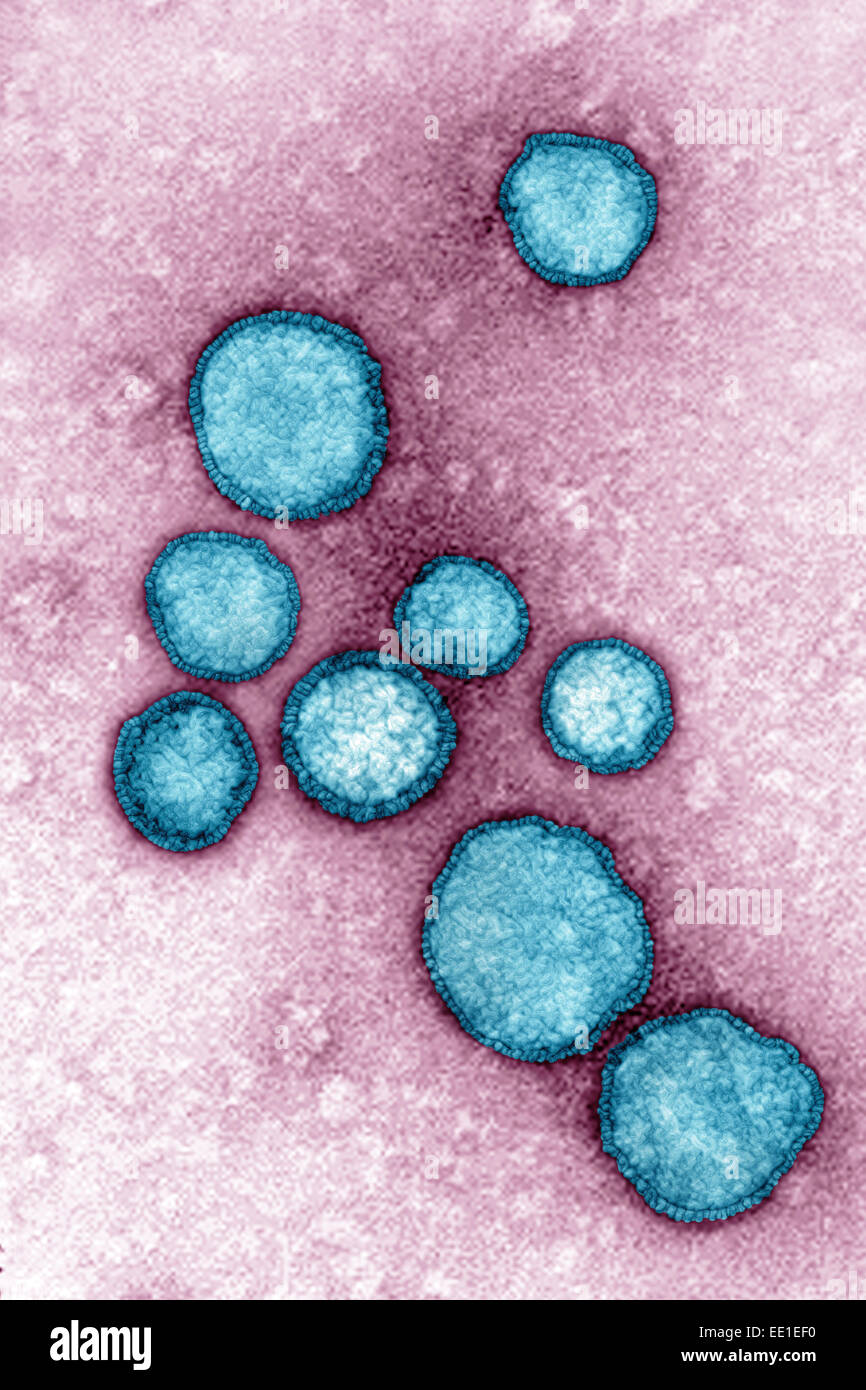 RESPIRATORY SYNCYTIAL VIRUS Stockfoto