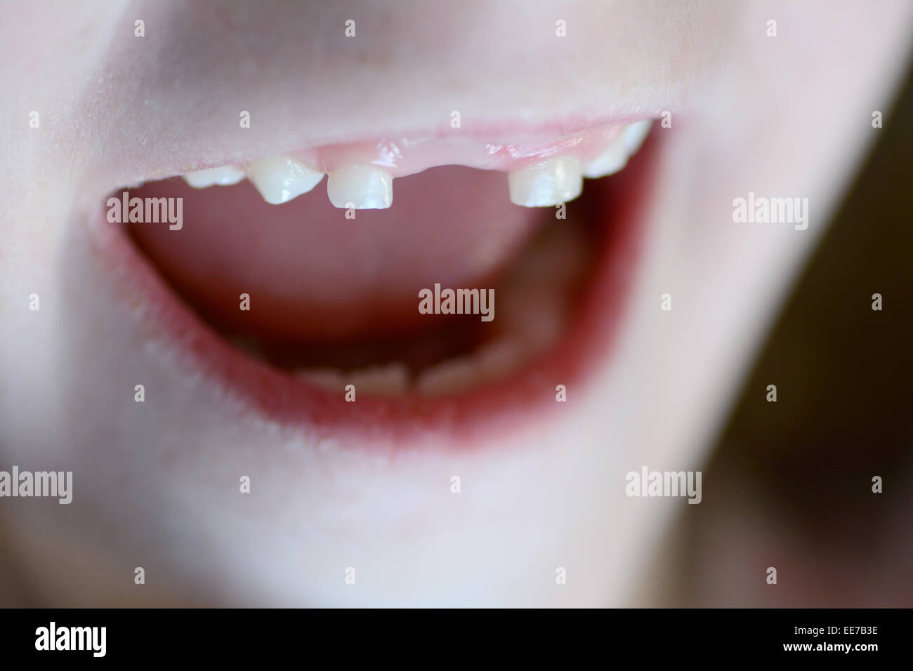 Kleines Kind lächelnd Porträt fehlende Schneidezahn Stockfoto