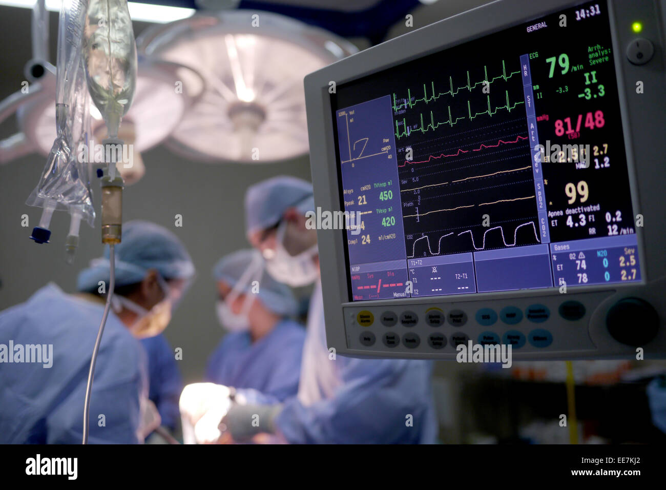Heart monitor -Fotos und -Bildmaterial in hoher Auflösung – Alamy