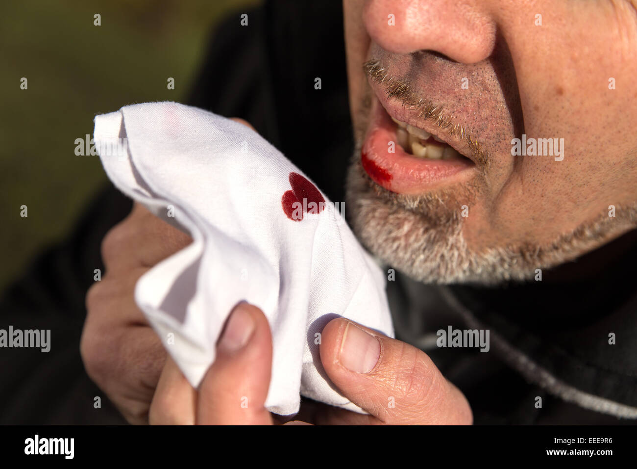 Nahaufnahme von einem Mann mit blutigen Gewebe Stockfoto