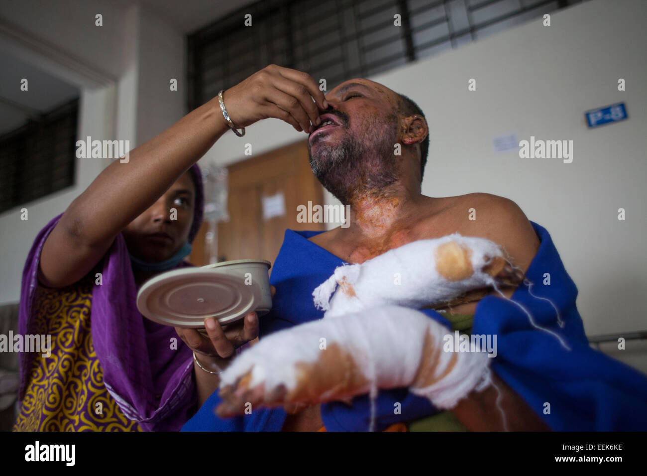 Dhaka, Bangladesch. 18. Januar 2015. Siddiqur Rahman Alter von 50 Jahren einen Auto-Rikscha-Fahrer von Mymensing stark von Brandanschlag während der kontinuierlichen landesweite politische Blockade verbrannt. Laut dortigen berichten mindestens 23 Menschen wurden getötet und 18 Todesopfer wurden zu brennen Einheit bewusst Set Brände zugelassen Handlungen Sabotage und Abfackeln von Fahrzeugen während der 16. Tag von Bangladesh Nationalist Party (BNP) führte 20-Partei unbestimmte Blokade von Straßen, Eisenbahnen und Wasserstraßen. Bildnachweis: Zakir Hossain Chowdhury Zakir/Alamy Live-Nachrichten Stockfoto