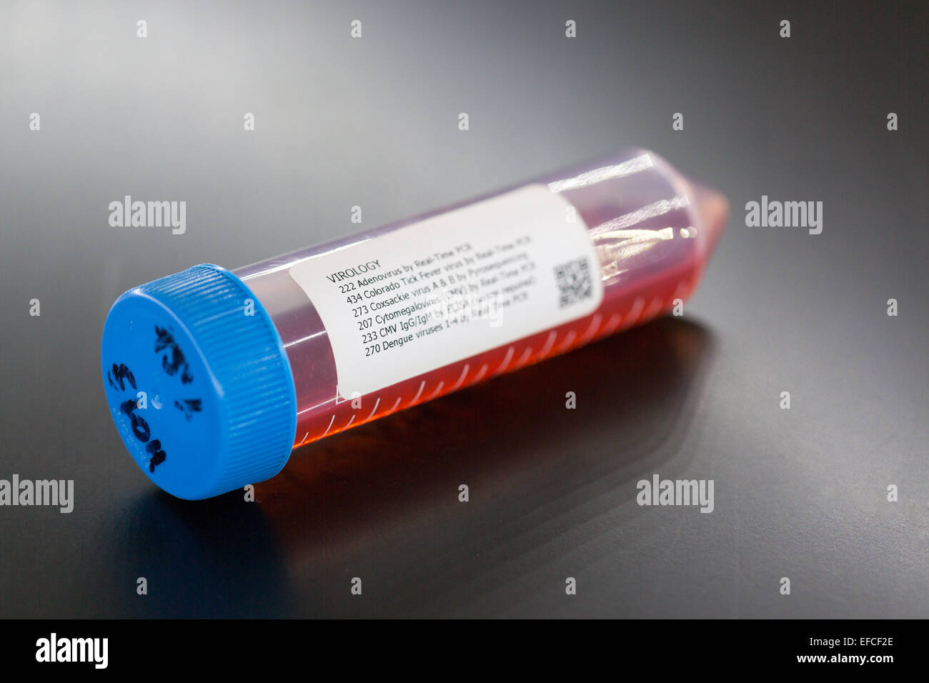 Virologie Reagenzglas mit Ebola-Proben Stockfoto