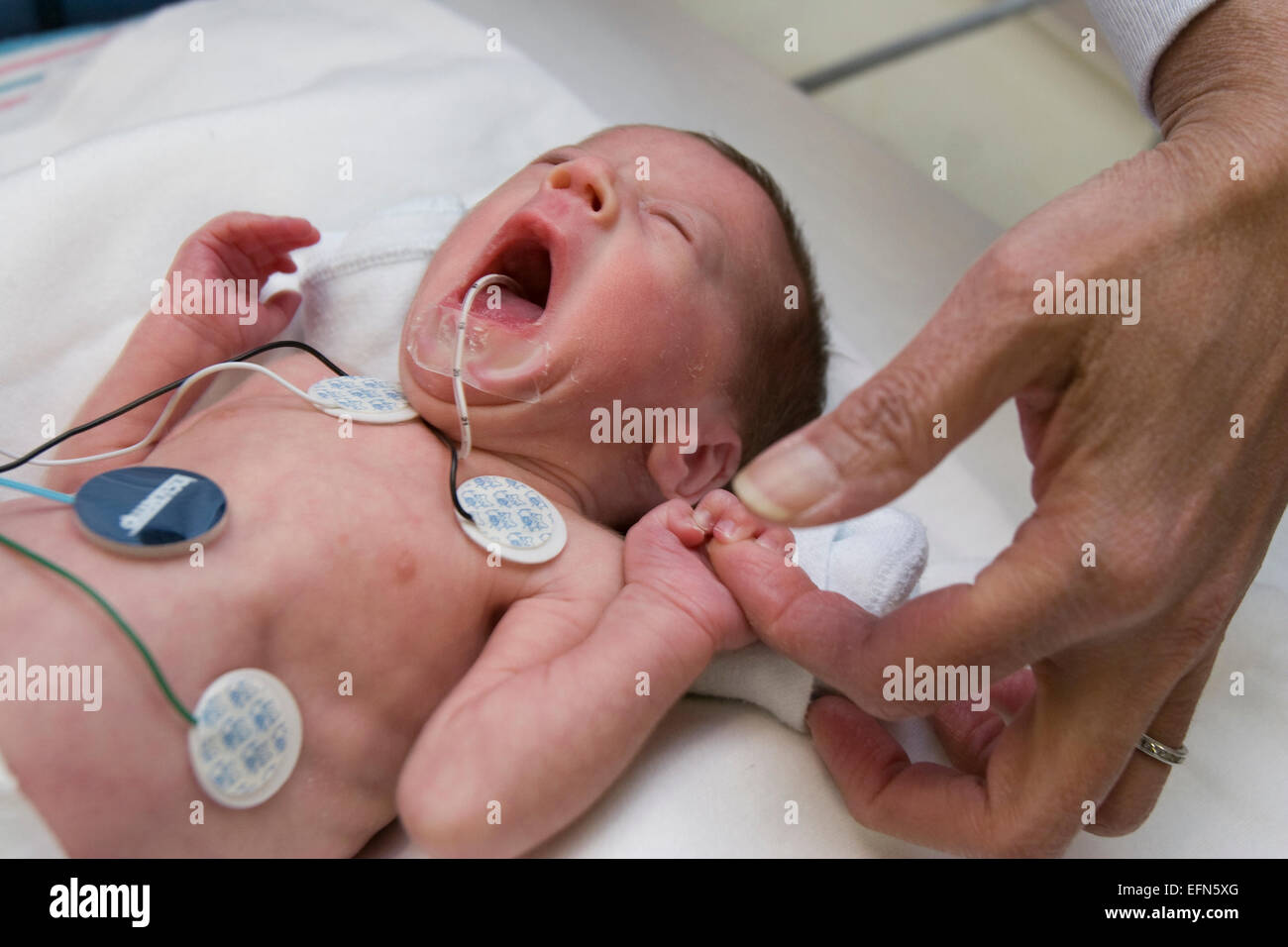 Frühchen in der Neonatologie-Einheit verdrahtet, um am Leben zu bleiben. Stockfoto