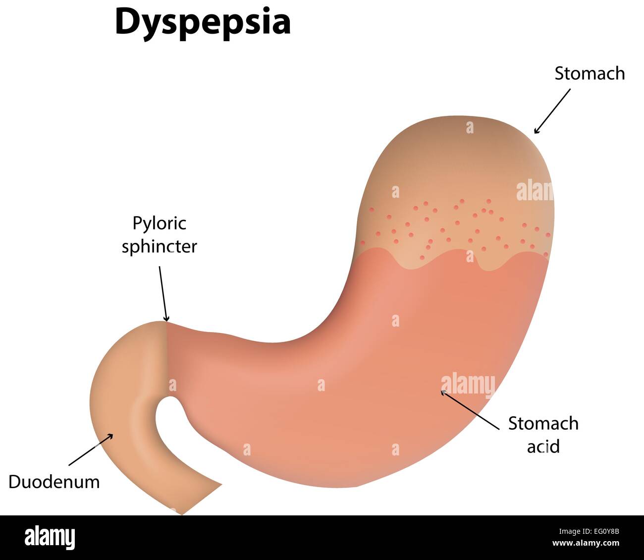 Dyspepsie Stock Vektor