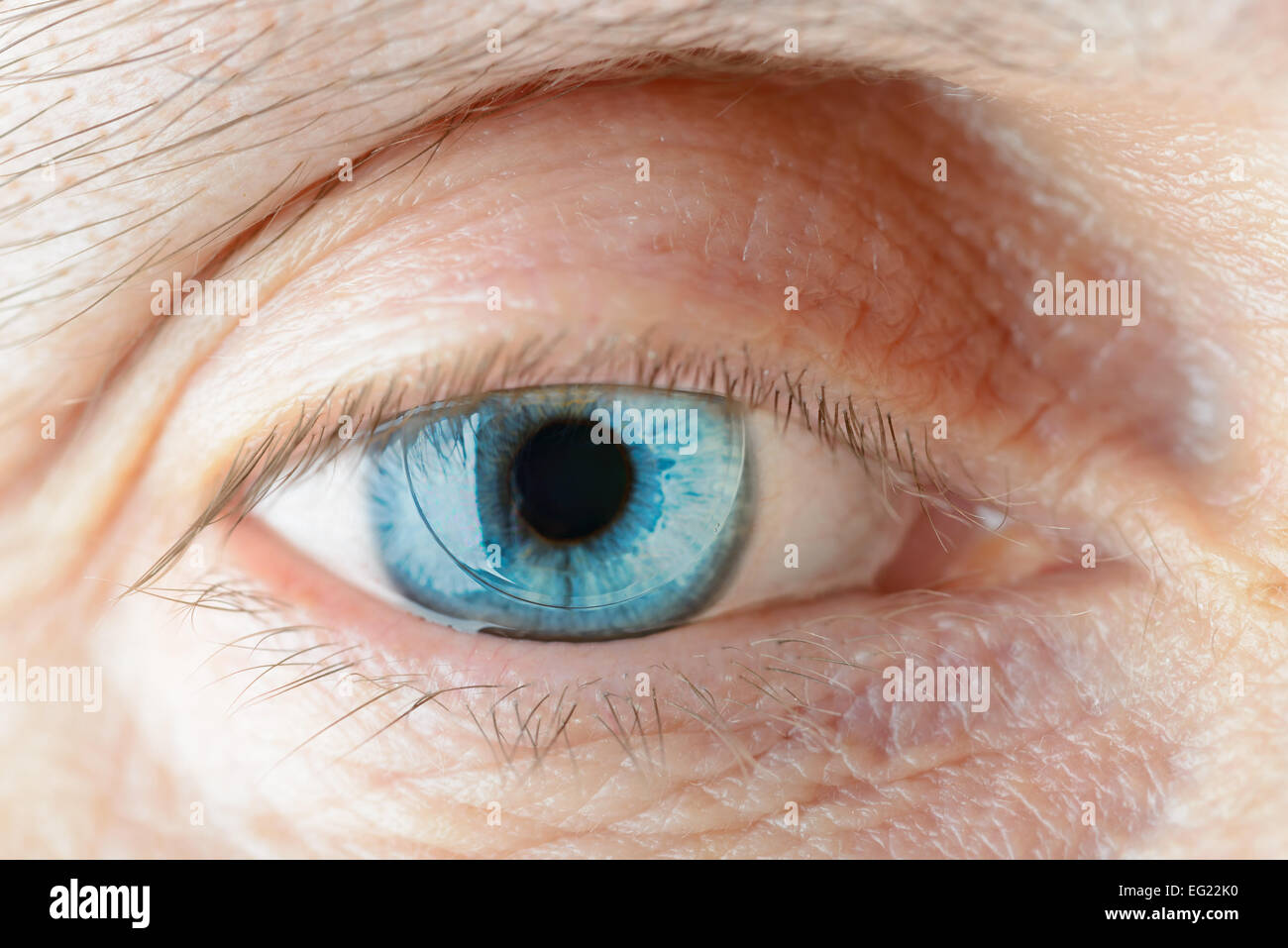 Makro von einer harten Kontaktlinse auf Frau blaues Auge Stockfoto