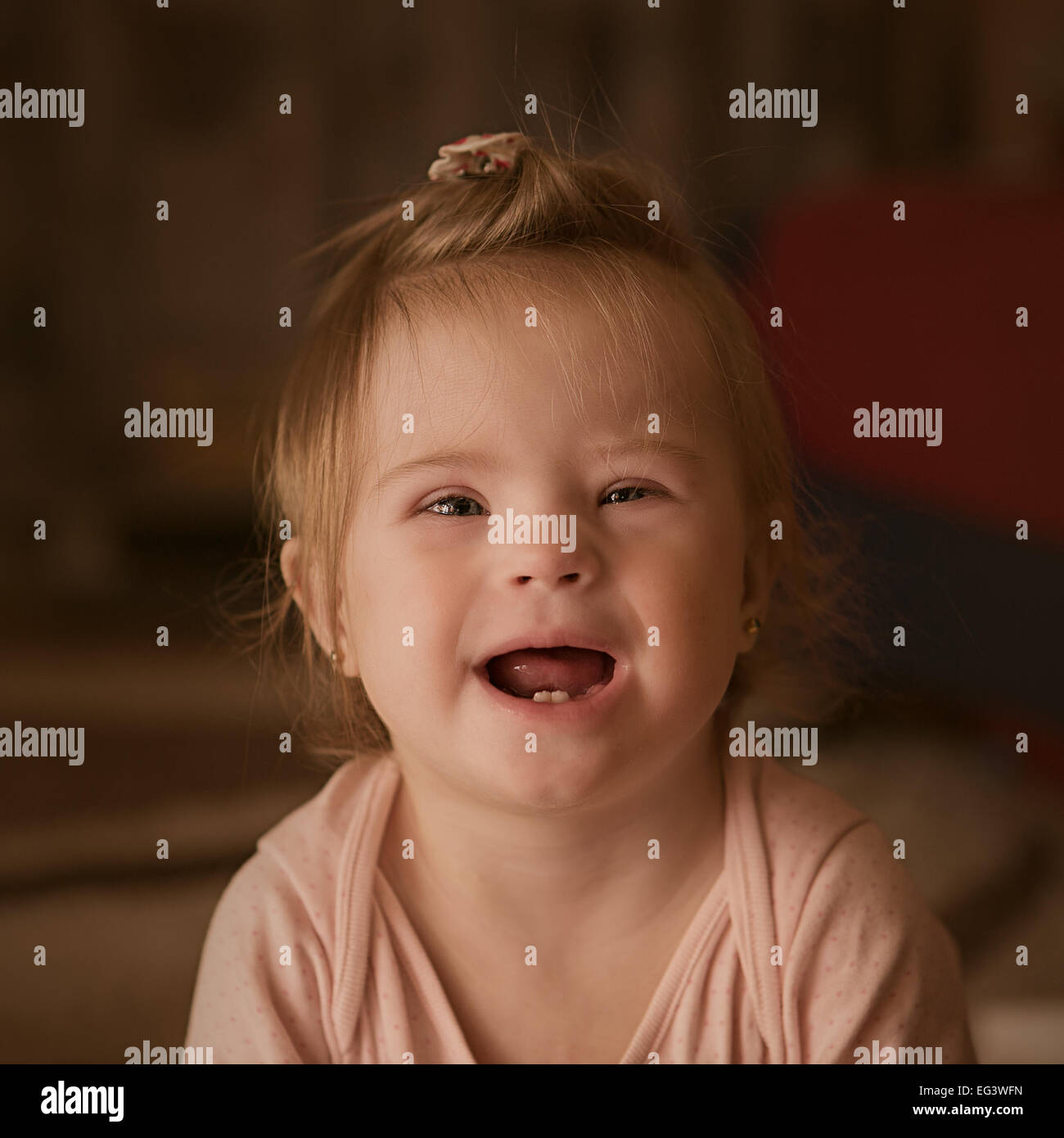 Emotionen von einem kleinen Mädchen mit Down-Syndrom Stockfoto