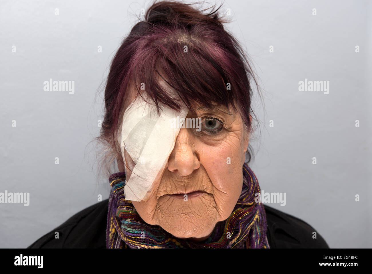 Frau trägt Bandage über ihr Auge nachdem er eine Katarakt-Operation entfernen Stockfoto