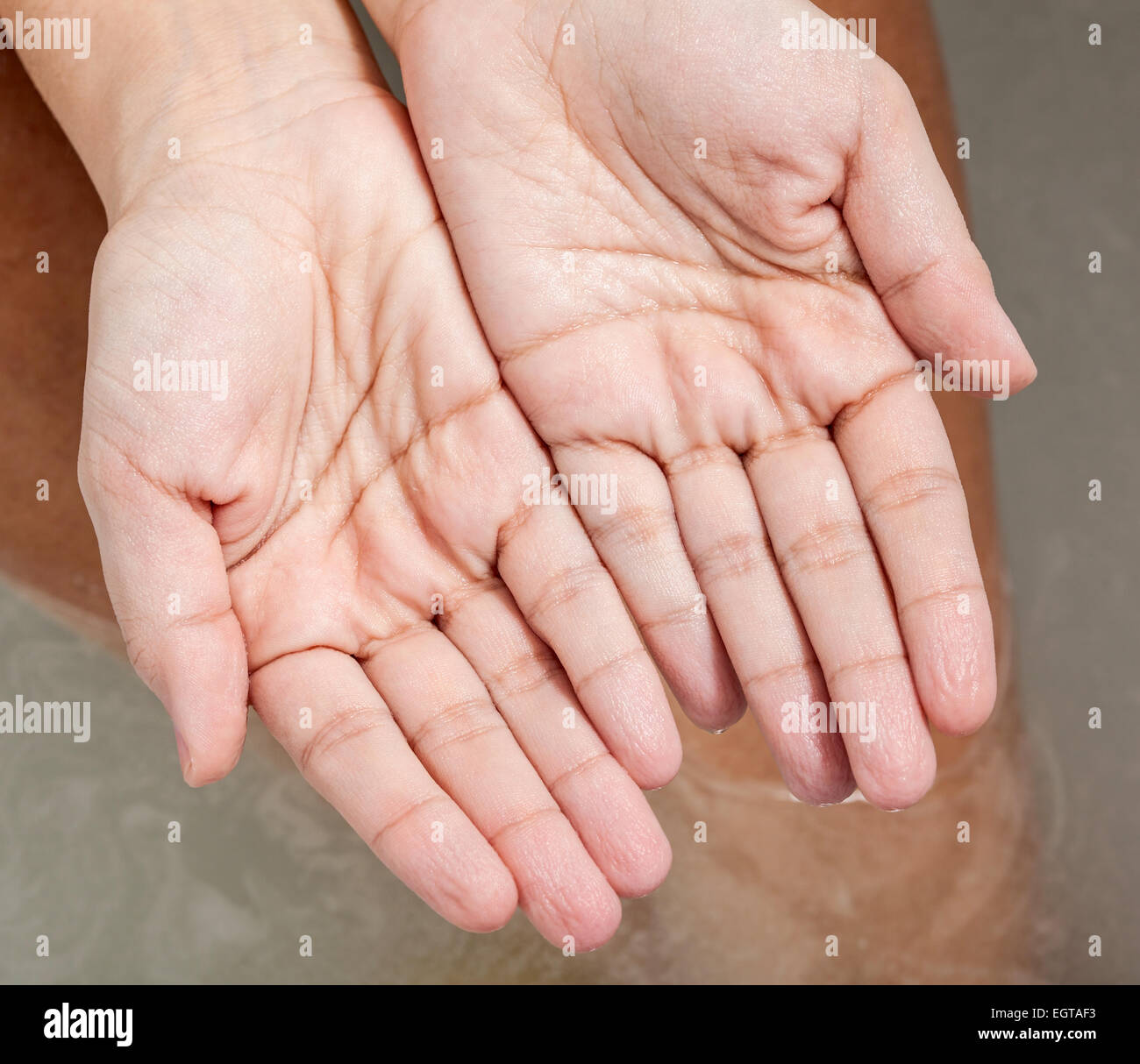 Faltige Haut an den Händen wegen der lange Zeit im Wasser. Stockfoto