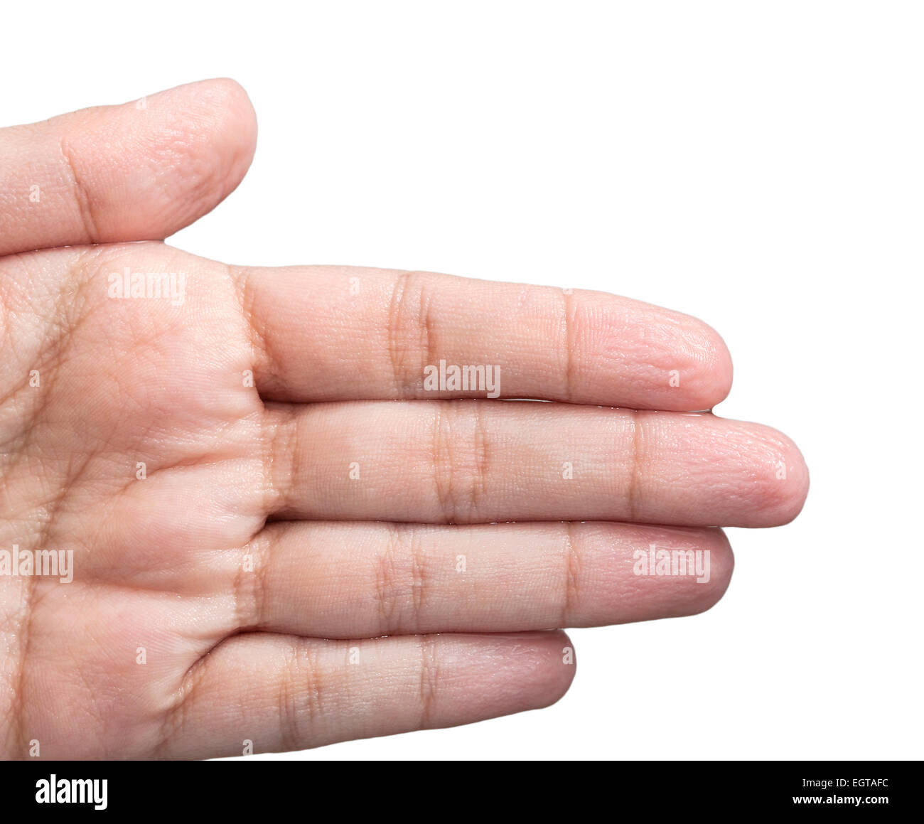 Faltige Haut an den Händen wegen der lange Zeit im Wasser. Stockfoto