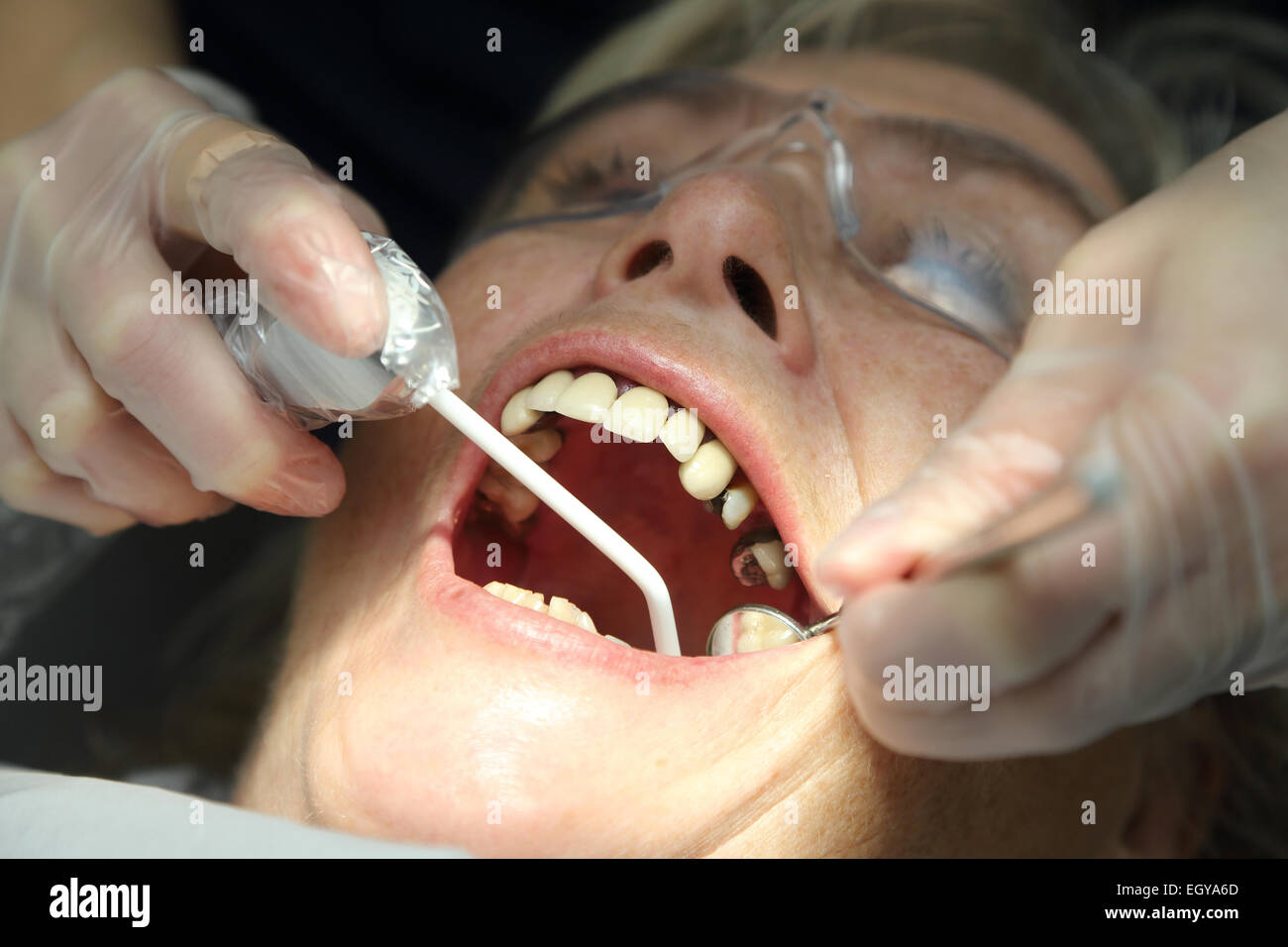 Frau beim Zahnarzt - Modell veröffentlicht Stockfoto