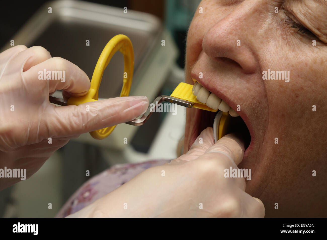 Frau beim Zahnarzt mit Röntgen-Modell veröffentlicht Stockfoto