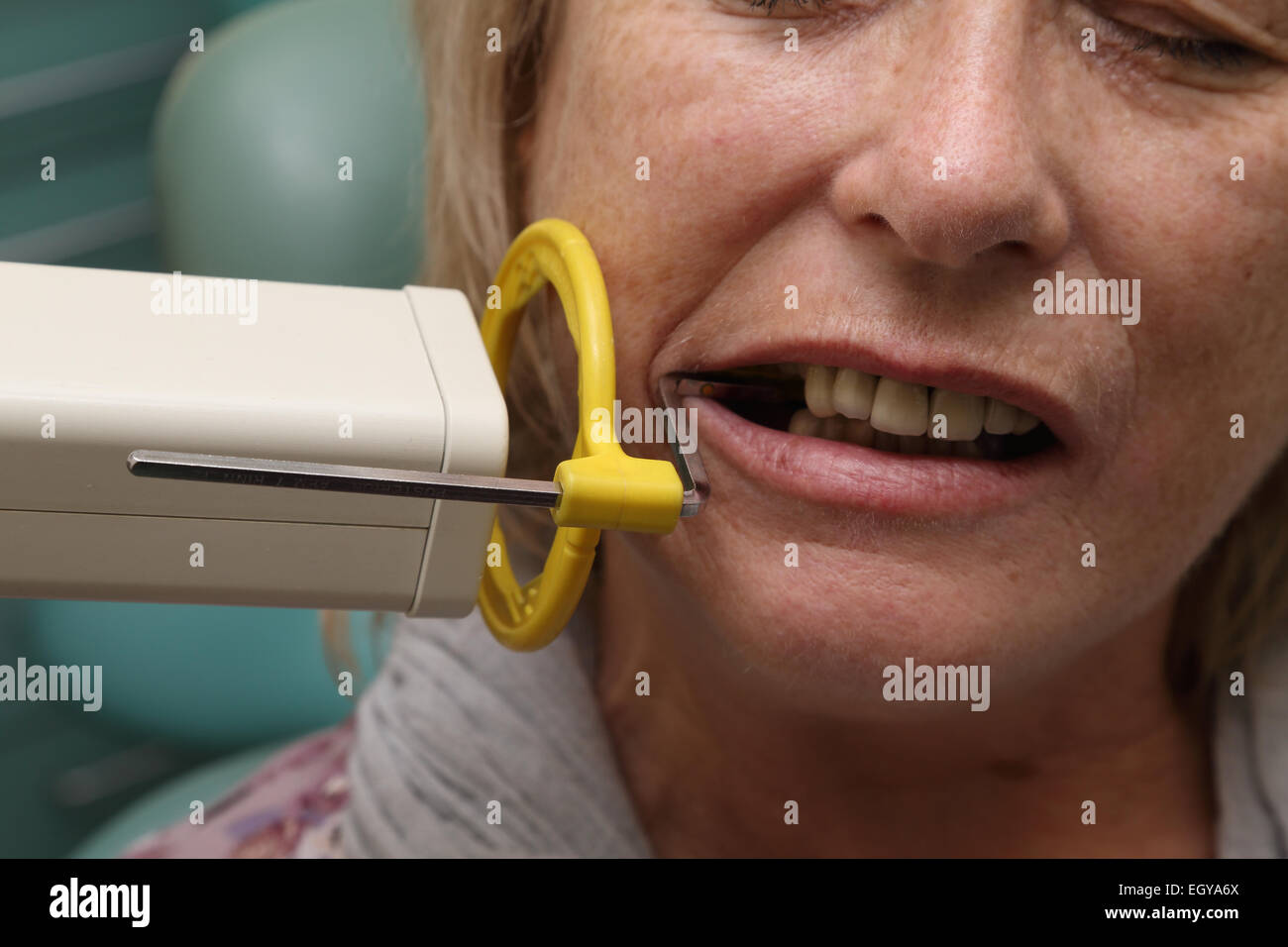 Frau beim Zahnarzt - Modell veröffentlicht Stockfoto