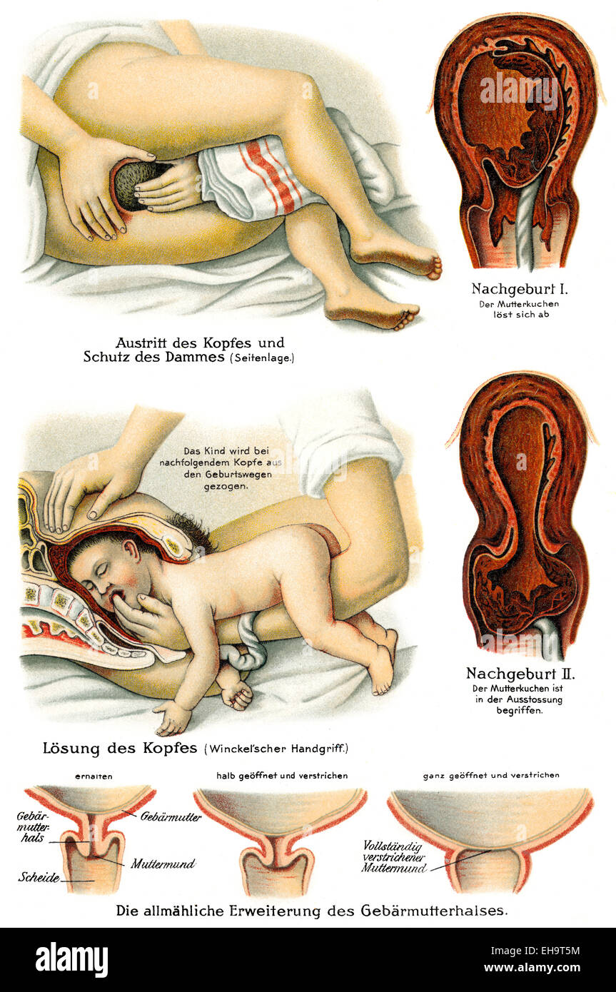 Geburtshilfe, Gesundheit Ratgeber, 19. Jahrhundert, Stockfoto