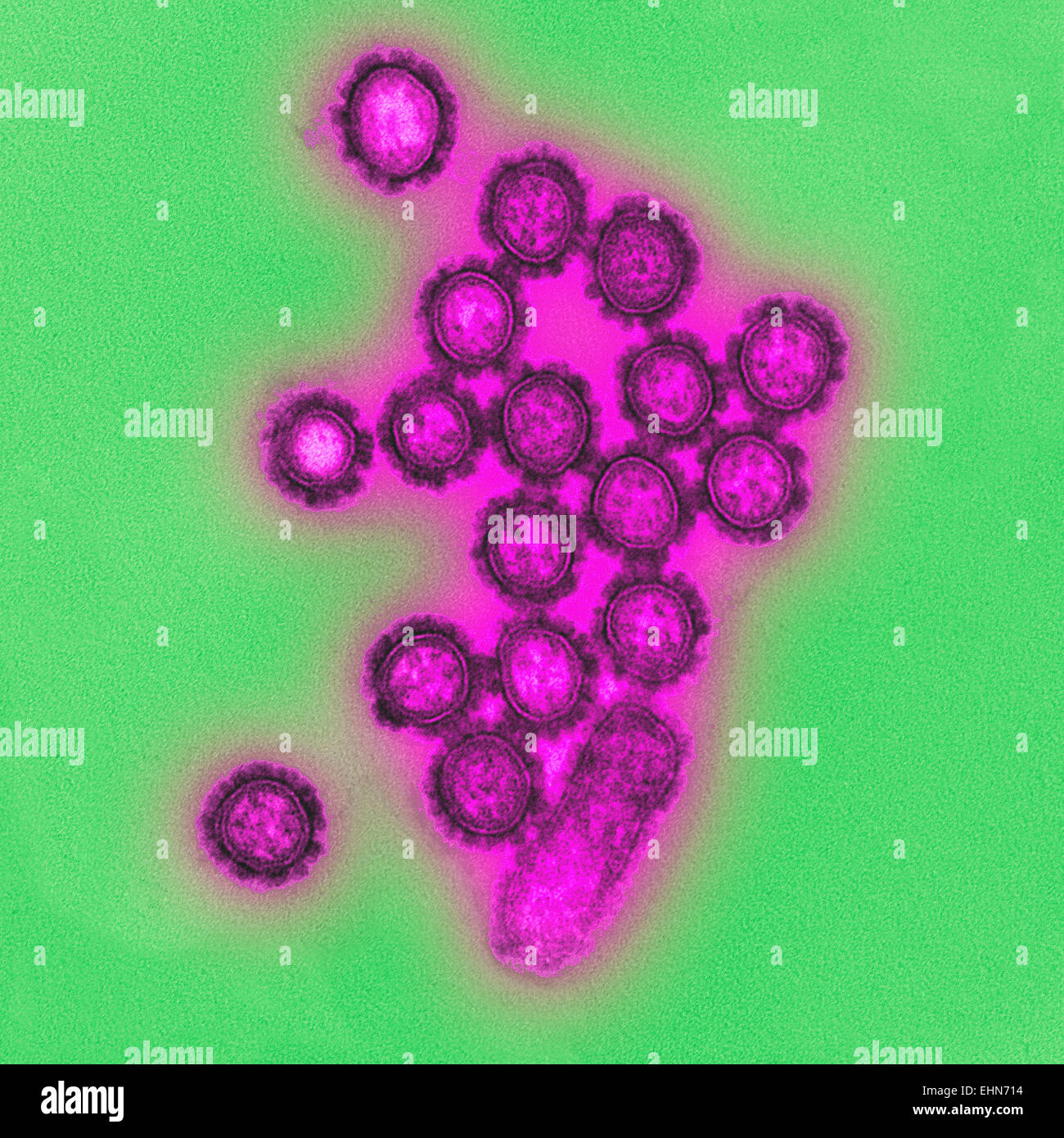 H1N1 Influenza Viruspartikel, Transmission Electron Schliffbild (TEM). Stockfoto