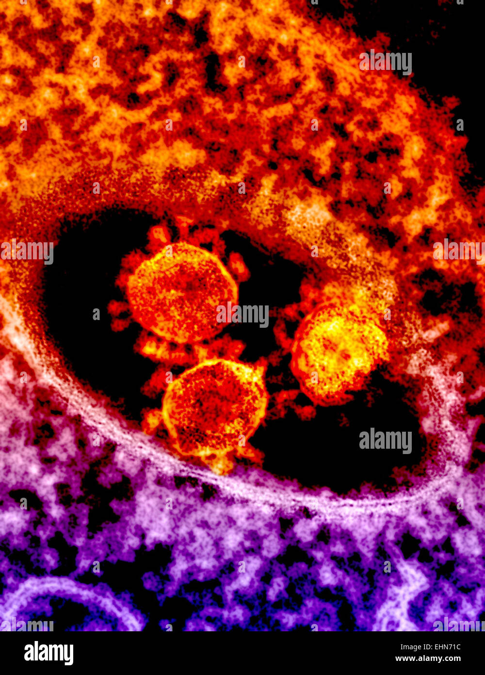 Farbige Transmission Electron Schliffbild (TEM) eines Partikels MERS Coronavirus, dieses Virus (ursprünglich neuartigen Corona-Virus 2012) wurde zum Nahen Osten respiratorisches Syndrom (MERS) Coronavirus. Stockfoto