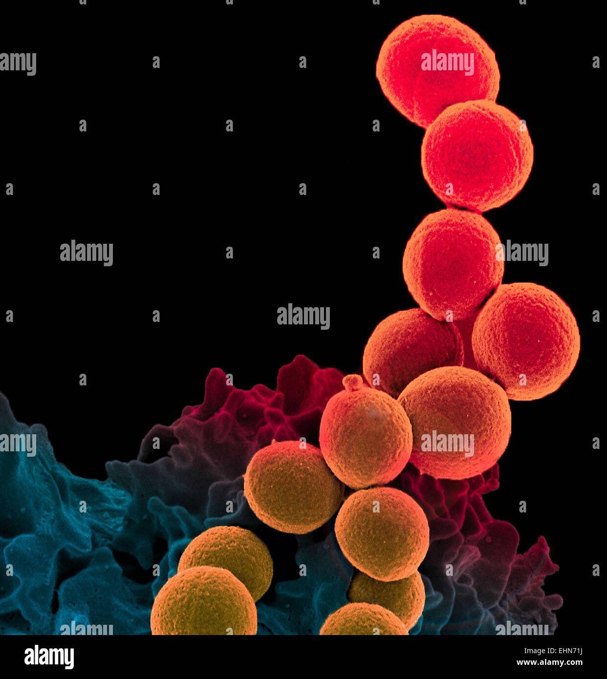 Farbige Scan Elektron Schliffbild (SEM) von einem Neutrophilen Leukozyten (unten) engulfing Methicillin-resistenten Staphylococcus Aureus-Bakterien (MRSA, gelb). Stockfoto