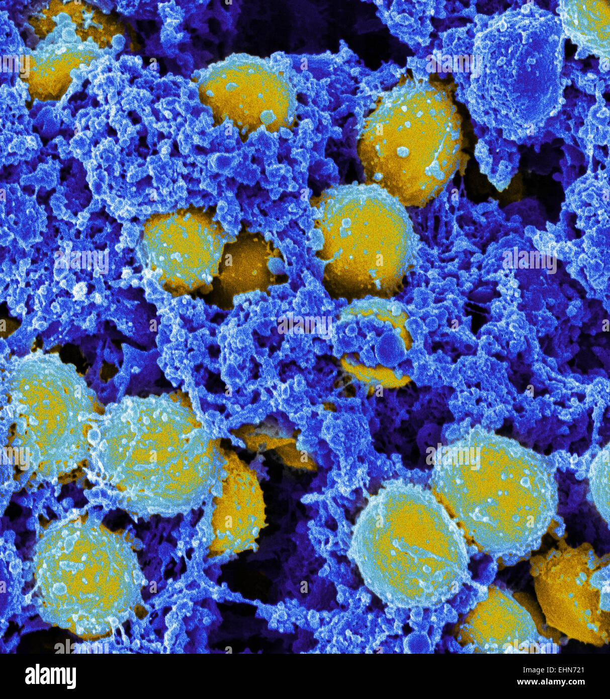 Farbige scanning Electron Schliffbild (SEM) von Methicillin-resistenten Staphylococcus Aureus (MRSA) Bakterien. Stockfoto