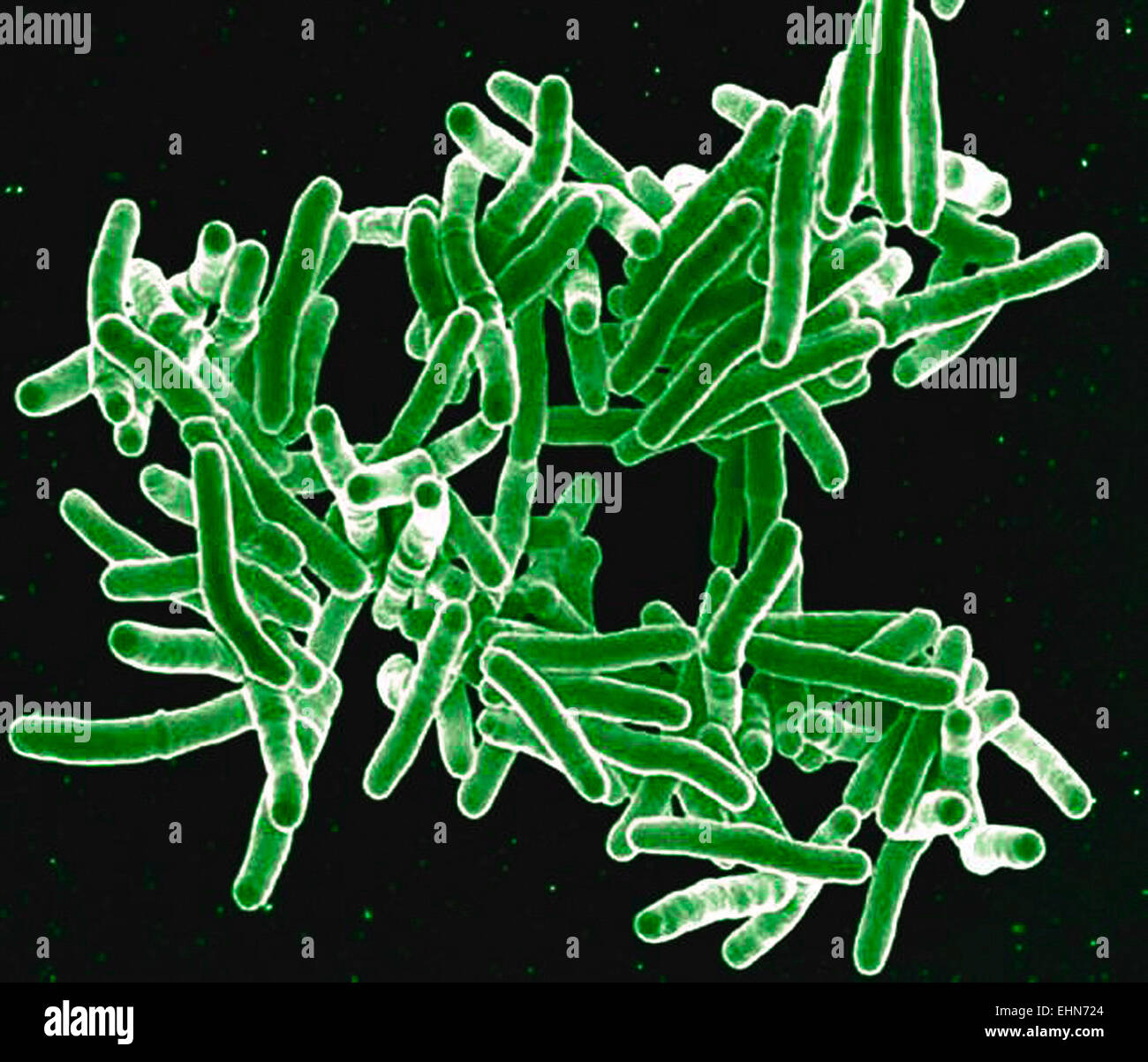 Mycobacterium-Tuberkulose-Bakterien, diese grampositiven stabförmigen Bakterien Ursache der Krankheit Tuberkulose, eingefärbte scanning Electron Schliffbild (SEM). Stockfoto