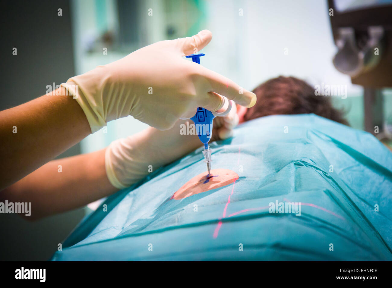 CT-Scan-gestützte Biopsie, Saint-Louis Krankenhaus, Paris, Frankreich. Stockfoto