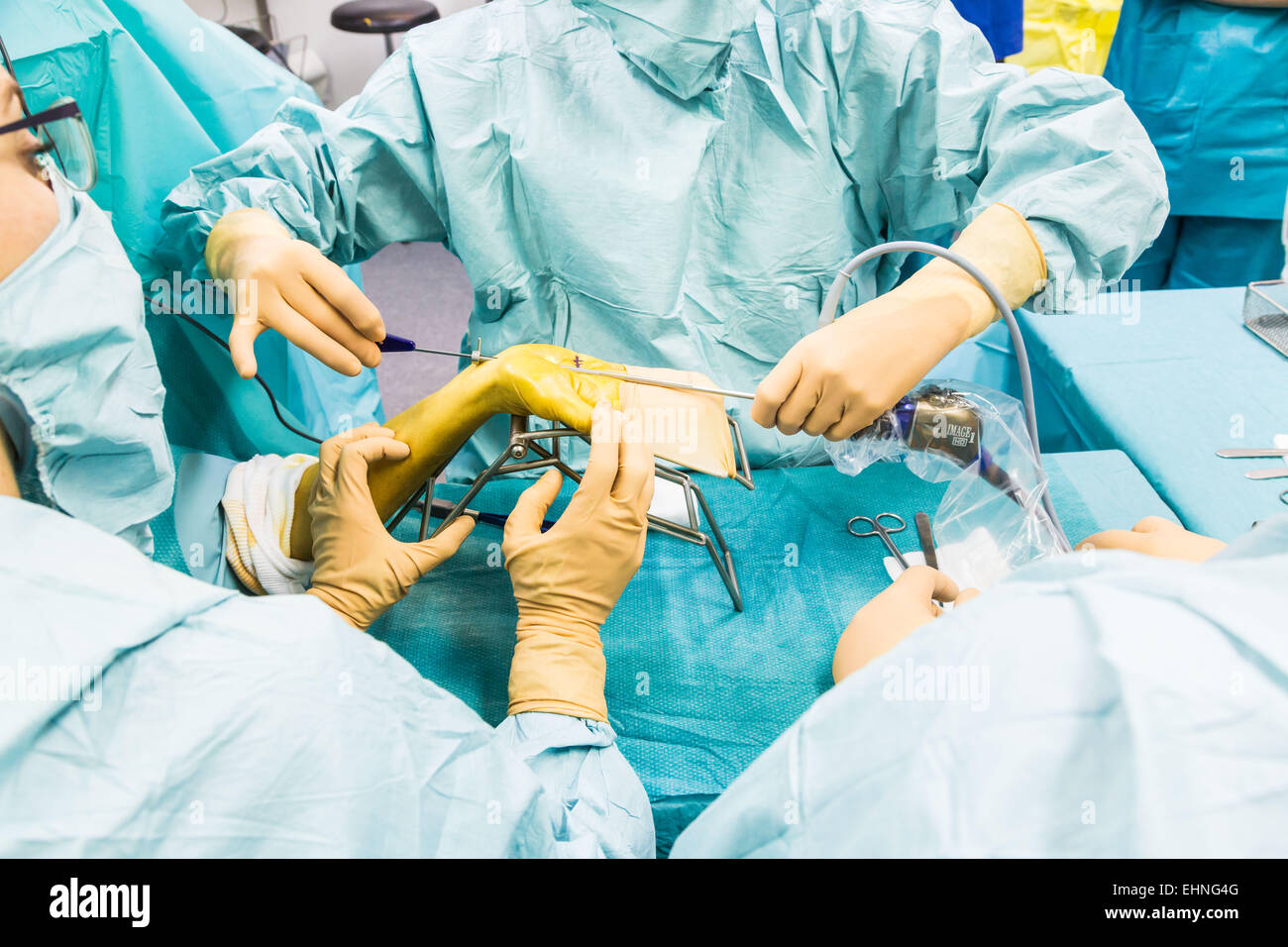 Karpaltunnel-Syndrom-Operation, Jouvenet Klinik, Paris, Frankreich. Stockfoto