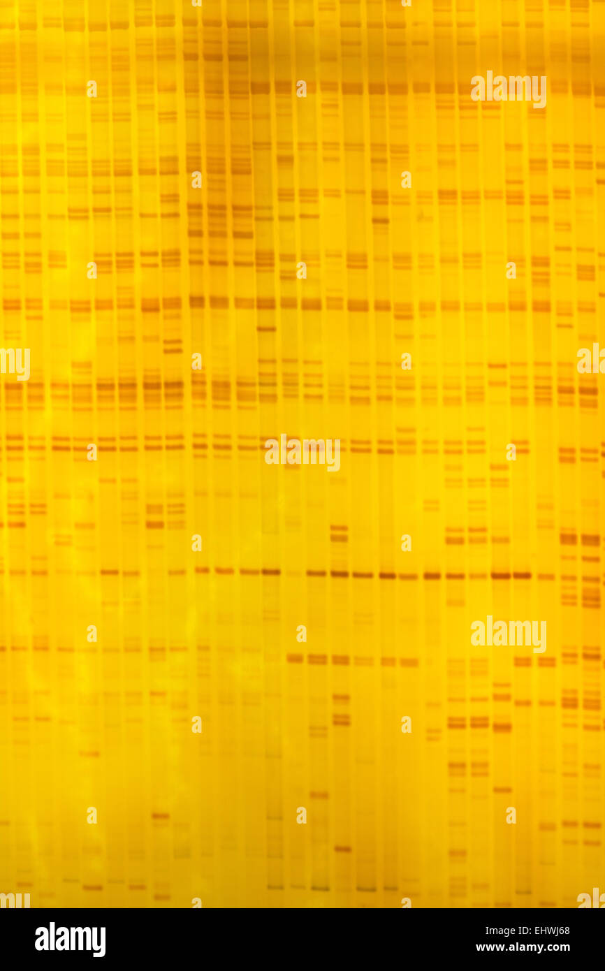 DNA-Fingerabdruck-Anlage auf Acrylamine-Gel-Elektrophorese-Ergebnis Stockfoto