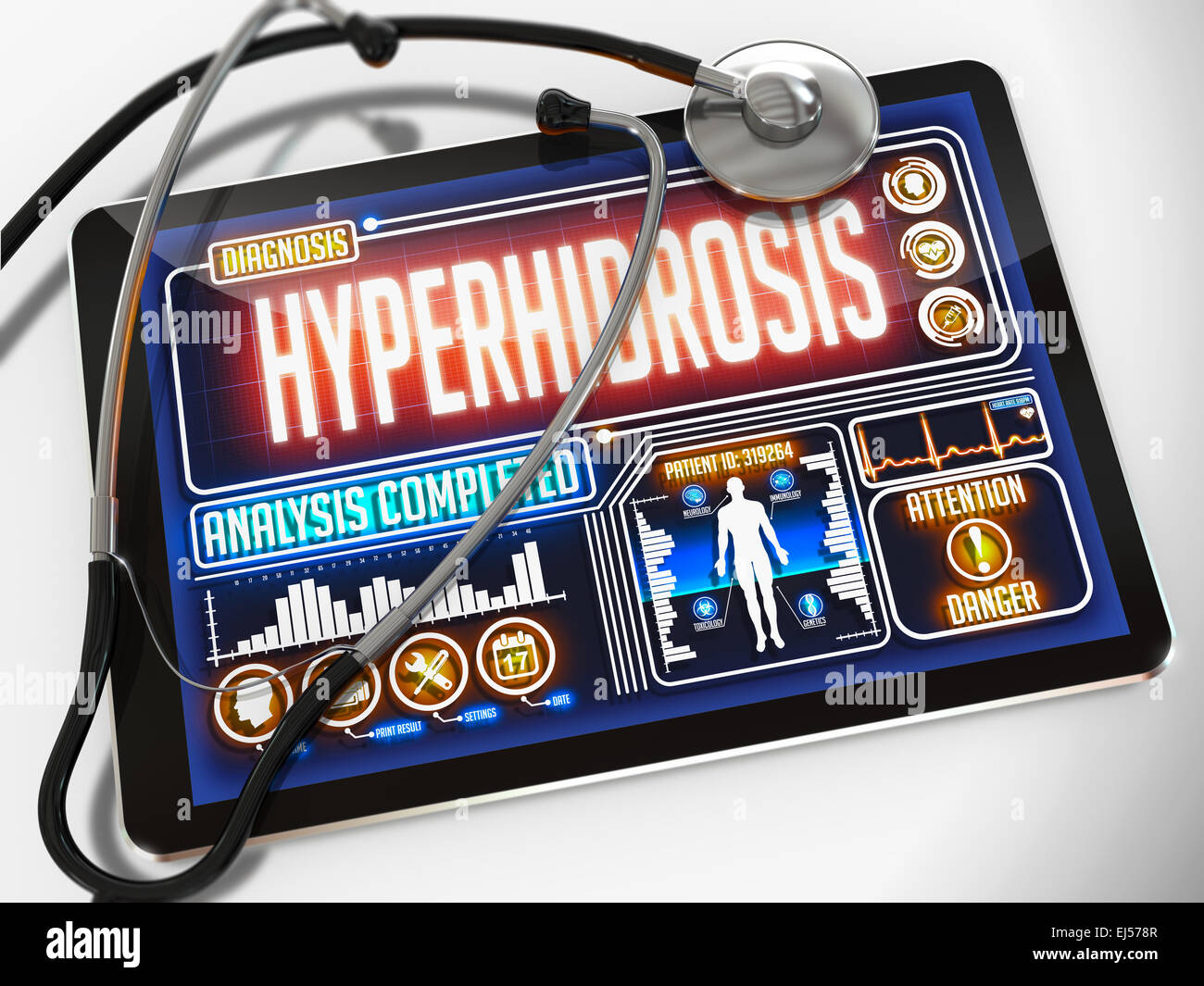 Hyperhidrose auf dem Display des medizinische Tablet. Stockfoto