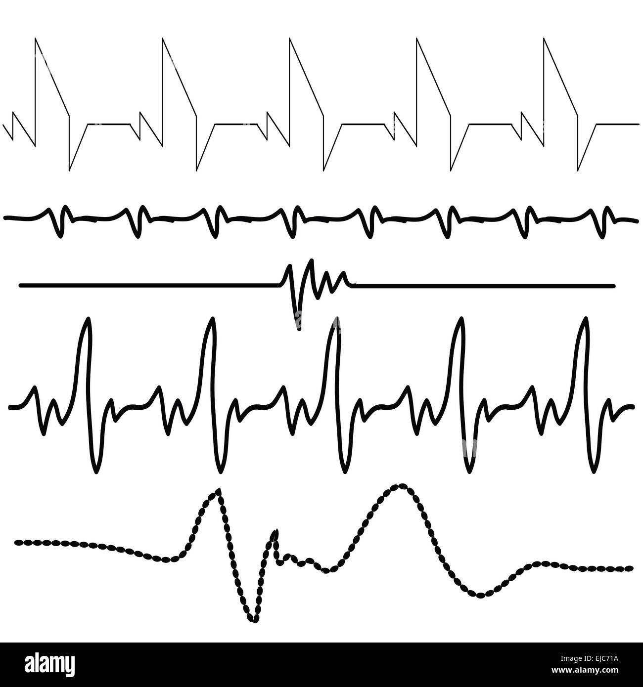 Elektrokardiogramm Stockfoto