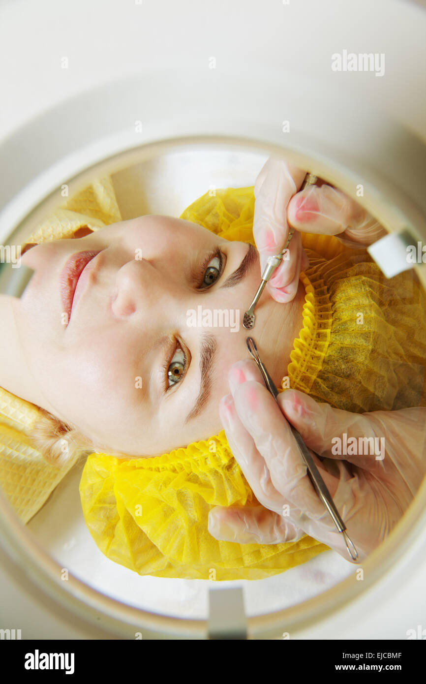 Frau am Gesicht epilation Stockfoto