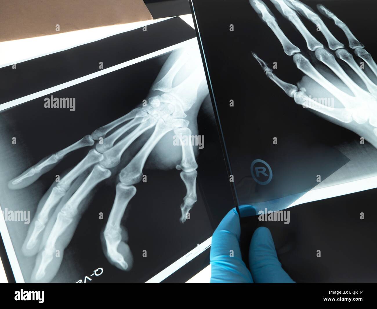Radiologie röntgenaufnahme -Fotos und -Bildmaterial in hoher Auflösung ...