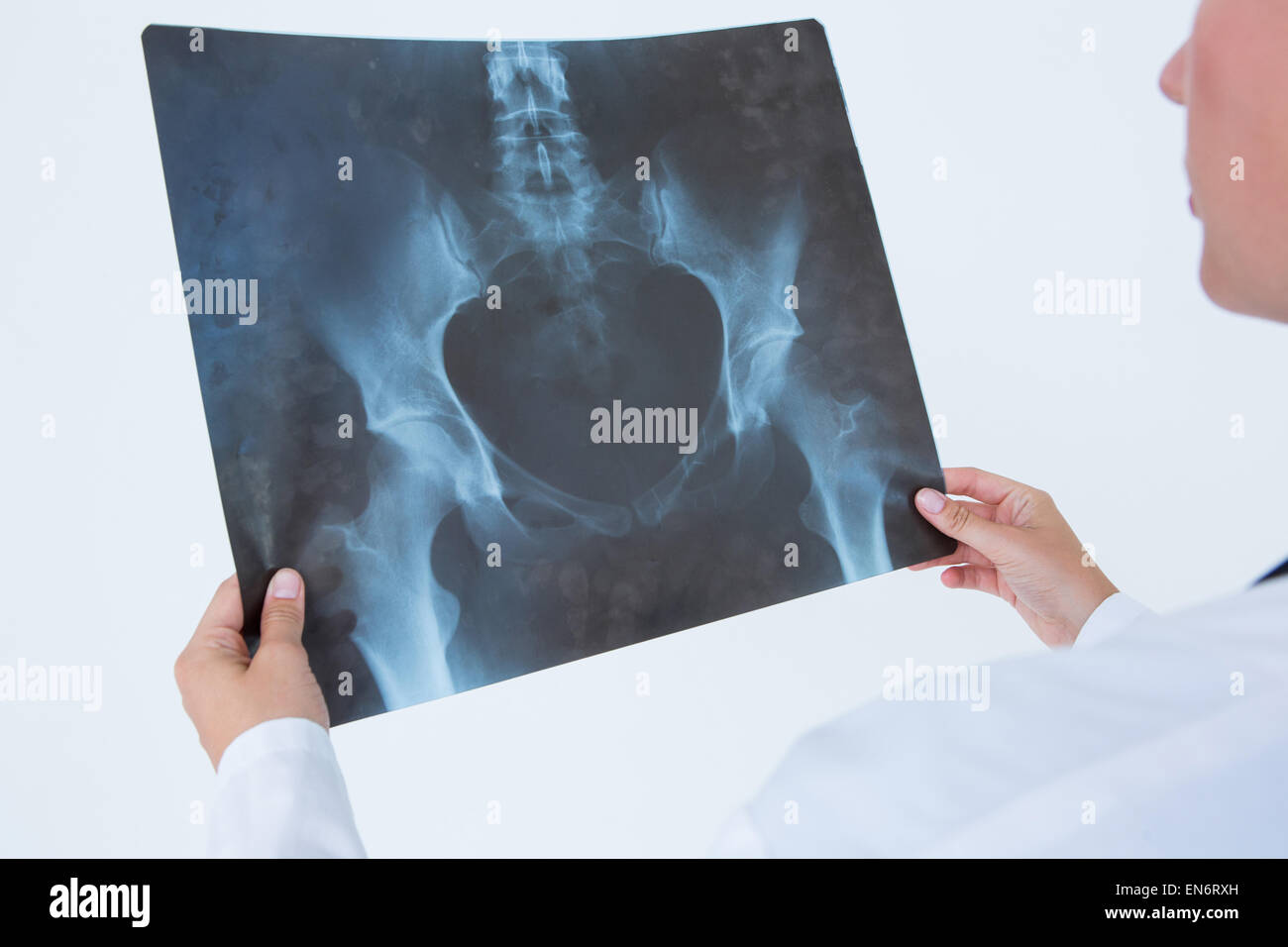 Konzentrat-Arzt Röntgenaufnahmen betrachten Stockfoto