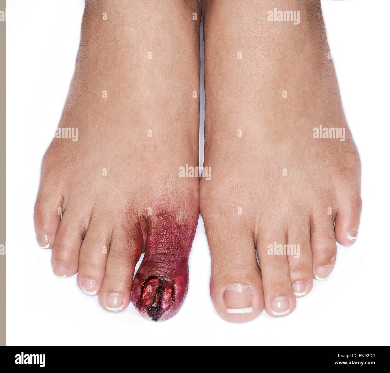verletzten weiblichen Zehen Spezialeffekte machen Details Stockfoto