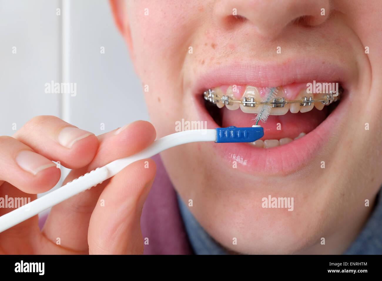 Teenager, die Reinigung seiner Zähne und Klammern mit einem Pinsel hautnah Stockfoto