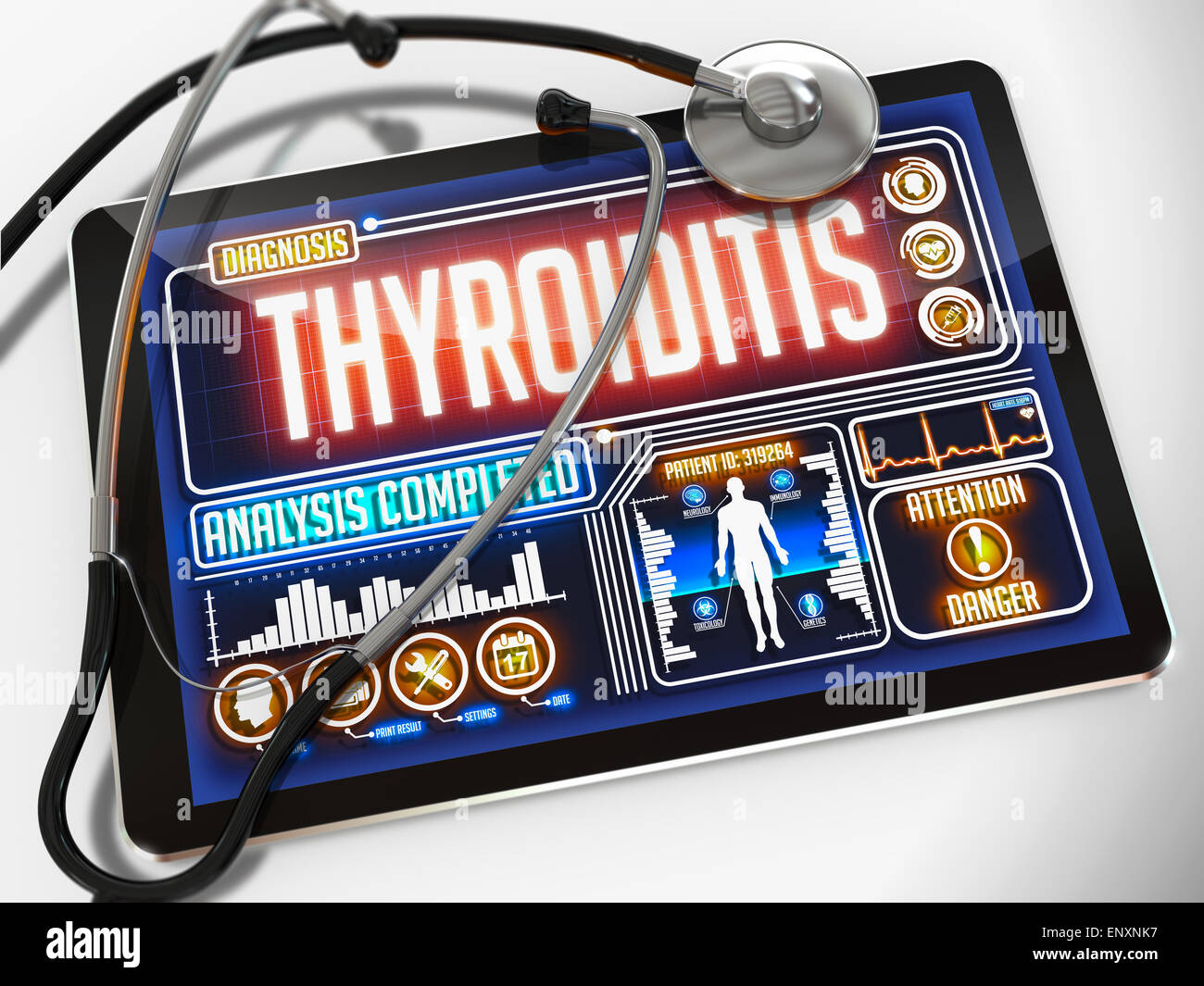 Thyreoiditis auf dem Display des medizinische Tablet. Stockfoto